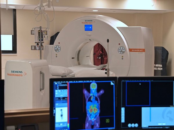 Pet Ct Scan Fusion Diagnostics